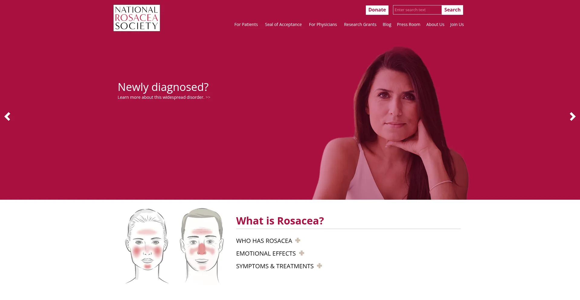 Website screenshot of Rosacea.org